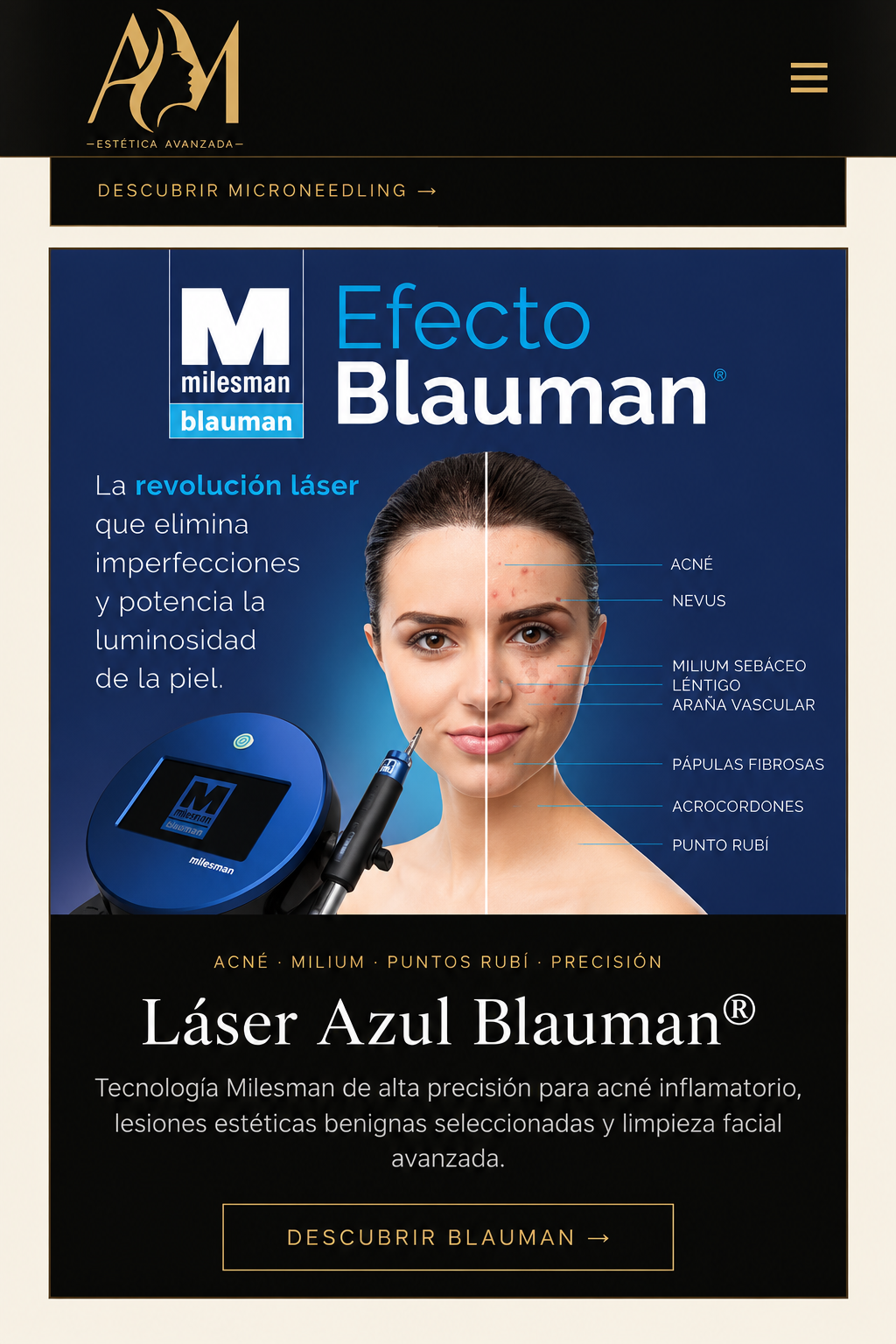 Láser Azul Blauman Milesman en AM Estética Avanzada Córdoba